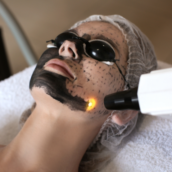 Carbon Laser Peel Treatment Process