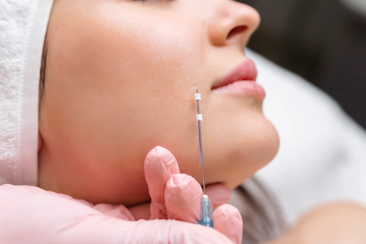Thread Lift Treatment Process