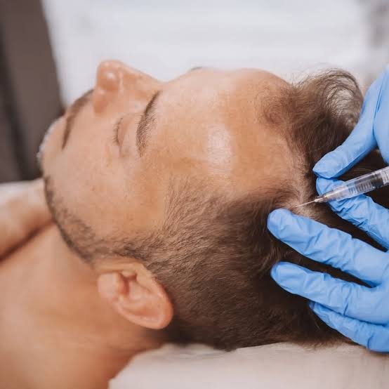 Hair PRP Therapy treatment process