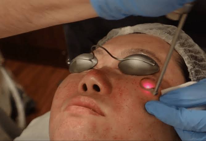 Advanced Pigmentation Correction Process