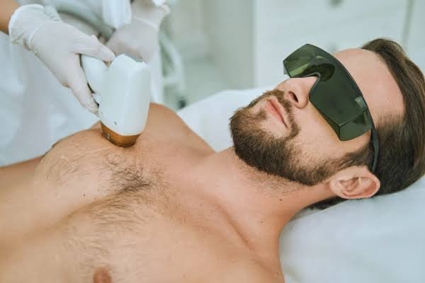 Laser Hair Reduction Treatment