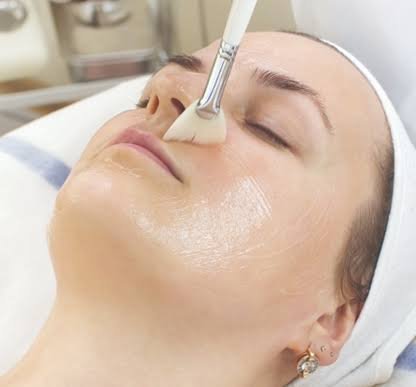 Mandelic Acid Peel Treatment