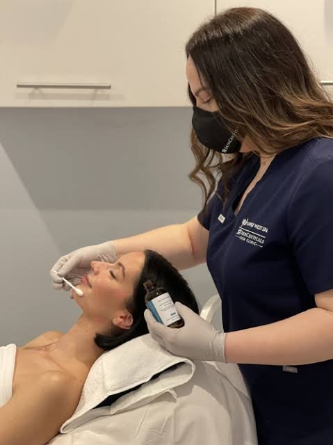 BHA Peel Process