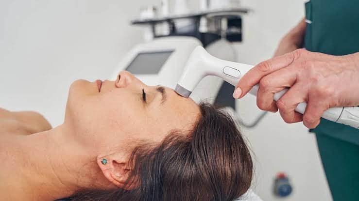 Radiofrequency Skin Tightening Process