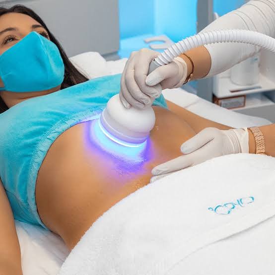 Cryotherapy Fat Reduction Treatment