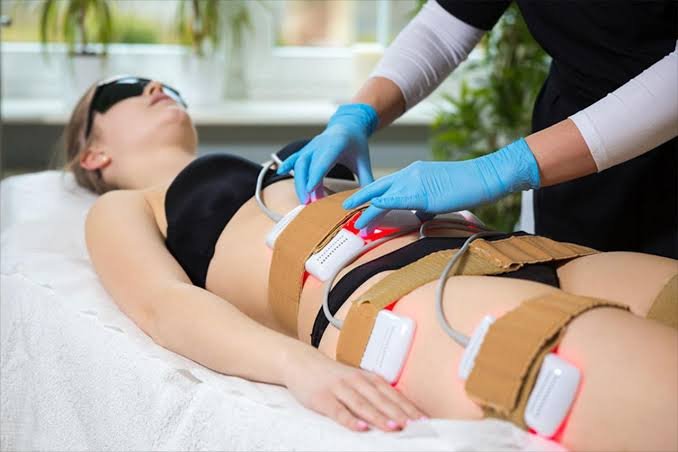 Lipo Laser Therapy treatment process
